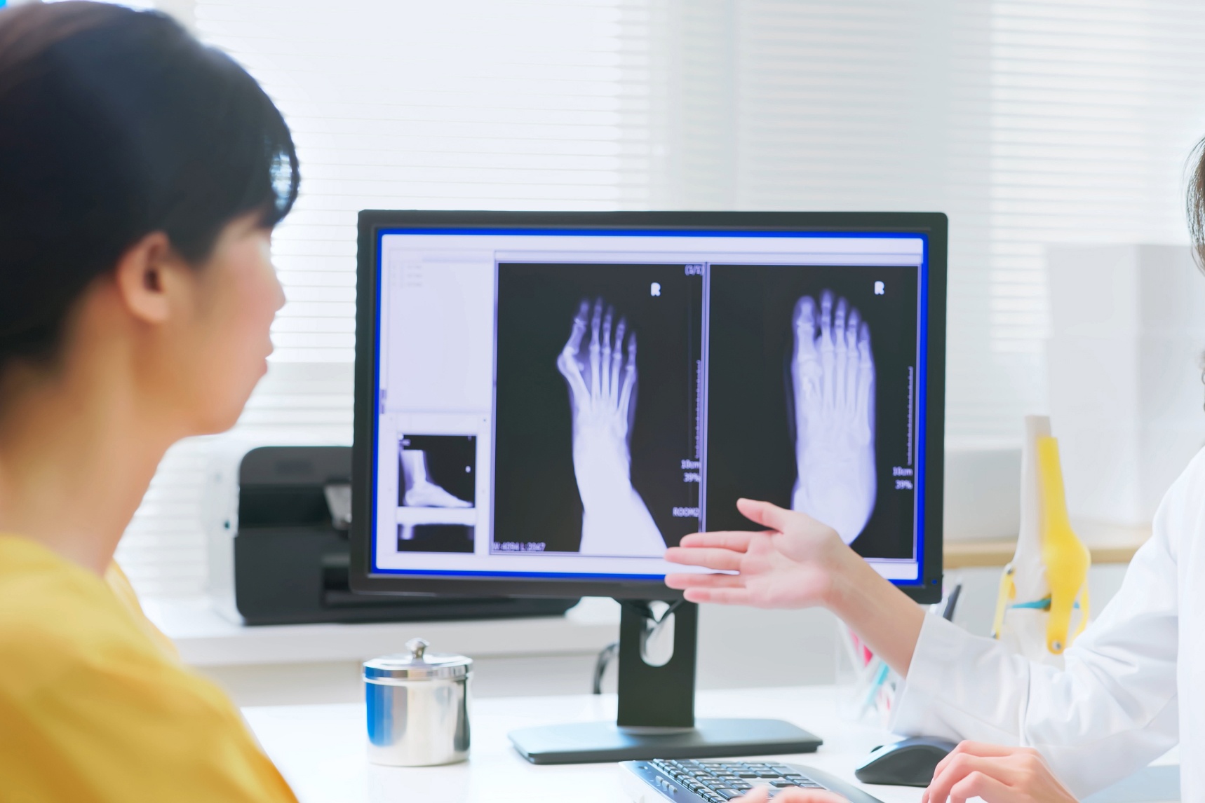 kiné ou chirurgie hallux valgus