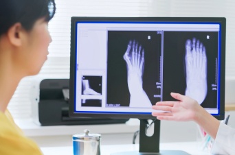 kiné ou chirurgie hallux valgus