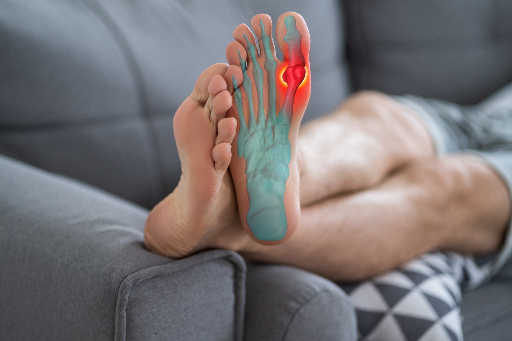 Aponevrosite plantaire